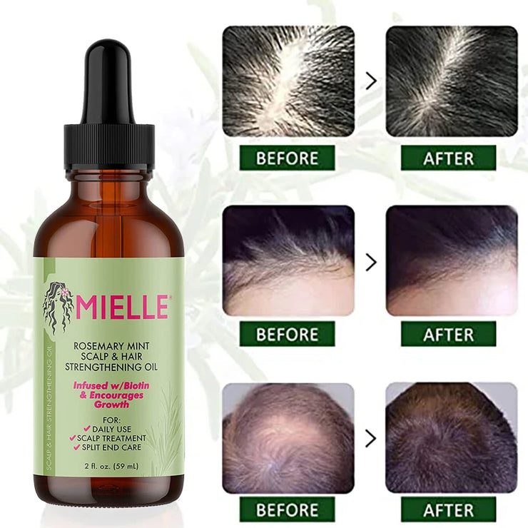 Hair Growth Essential Oil