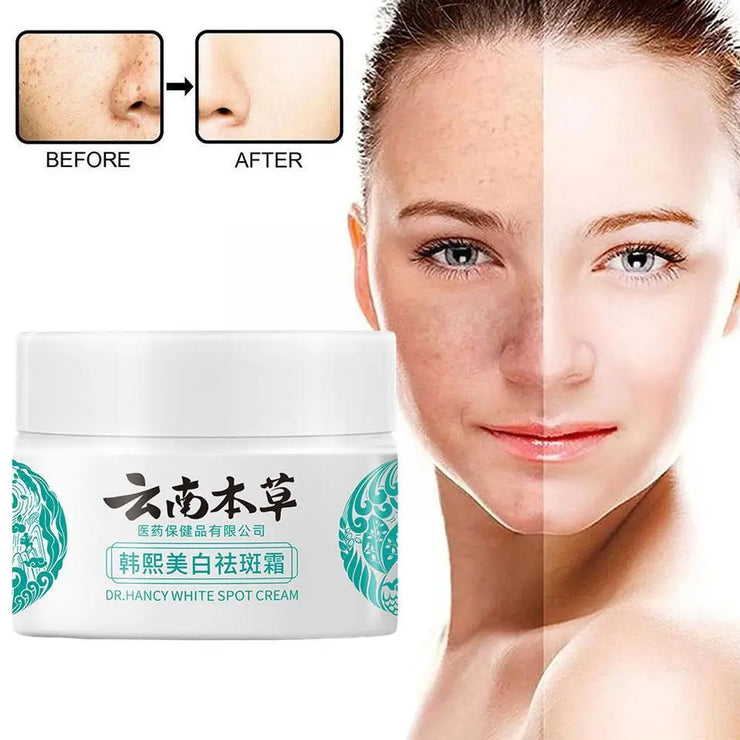 Dark Spots Removal Cream