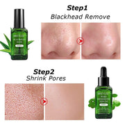 Blackhead Remover Serum - HOW DO I BUY THIS