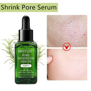 Blackhead Remover Serum - HOW DO I BUY THIS Pore Refining Serum