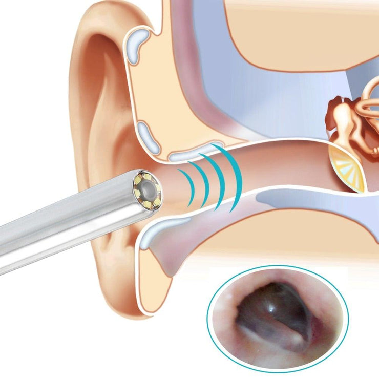 Ear Cleaning Endoscope - HOW DO I BUY THIS