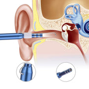 Ear Cleaning Endoscope - HOW DO I BUY THIS